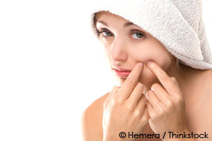 simple-acne-treatment7-21